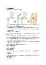 人工骨頭置換術